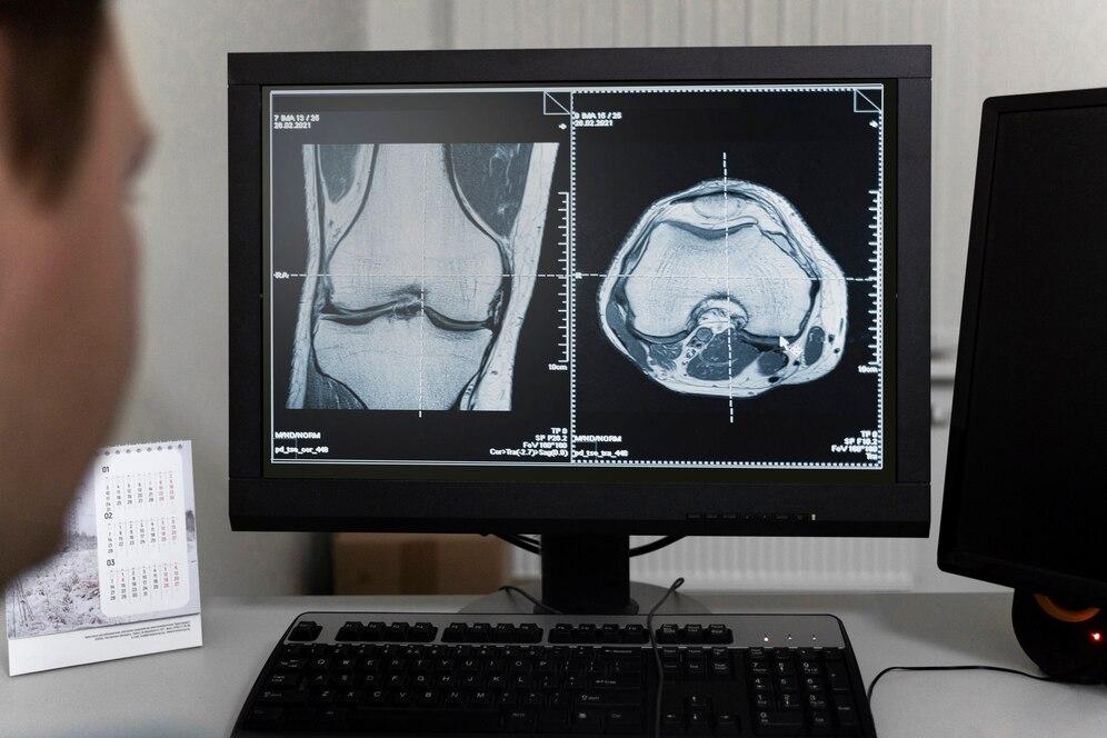 Революция в медицине: 3D-томография и ее применение